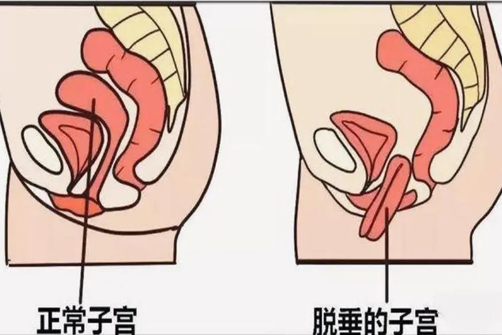 图层 34