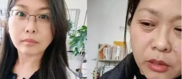 卵巢早衰会衰老很快吗？卵巢早衰真的会引起断崖式衰老吗？