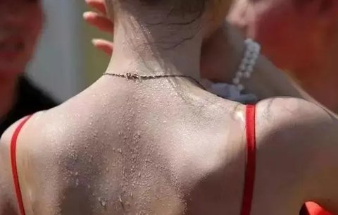 夏天出汗对身体有好处吗？夏天出汗的十大惊人好处