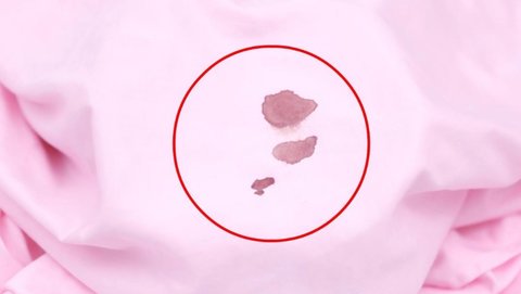 怎样去除血渍比较干净？去除血渍的小妙招