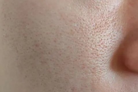 教你9种缩小毛孔方法：打造细腻肌肤的秘诀