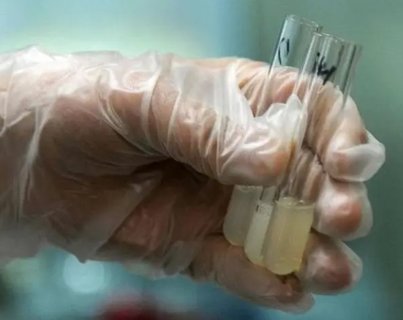 高质量精子是什么样的？揭秘生育关键因素