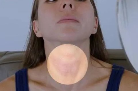 天天感觉疲劳与甲状腺有关吗？建议查一下甲状腺