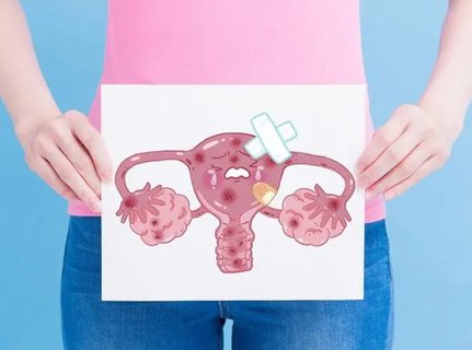 多囊卵巢能怀上孩子吗：解答PCOS与生育的可能性