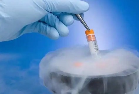 做试管需要关注哪些指标和内容？试管婴儿治疗的关键因素