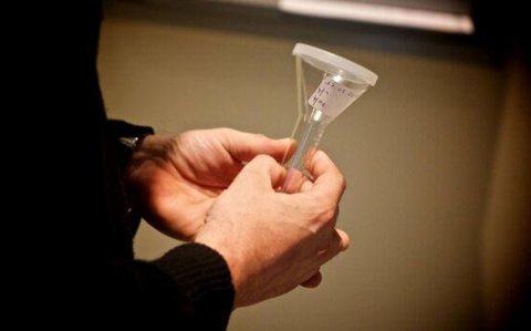 试管婴儿和人工授精有何区别？生殖辅助技术的比较分析