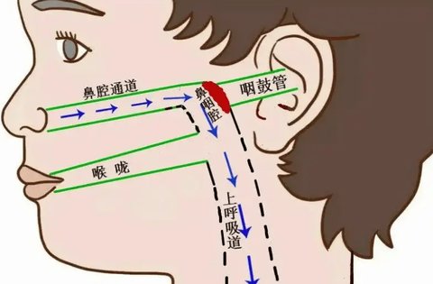 咽鼓管堵塞怎么疏通？咽鼓管堵塞自愈方法