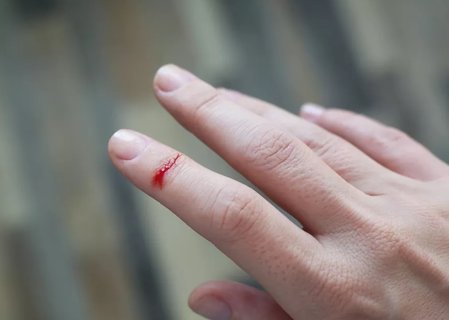 破伤风早期有哪些症状？破伤风早期的6个征兆