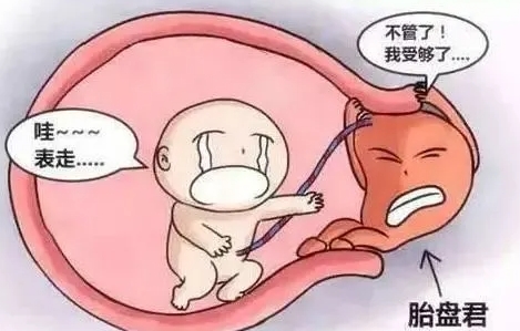 胎盘早剥是什么原因造成的？胎盘早剥的原因和症状