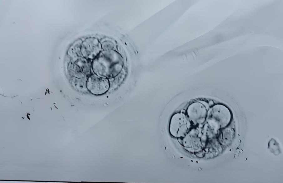 囊胚4AA常见还是4BB常见,不同级别囊胚出现的概率