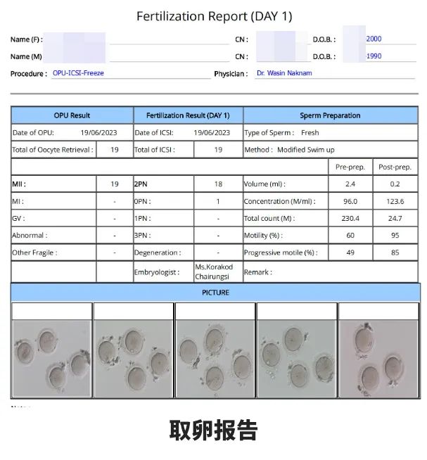取卵报告