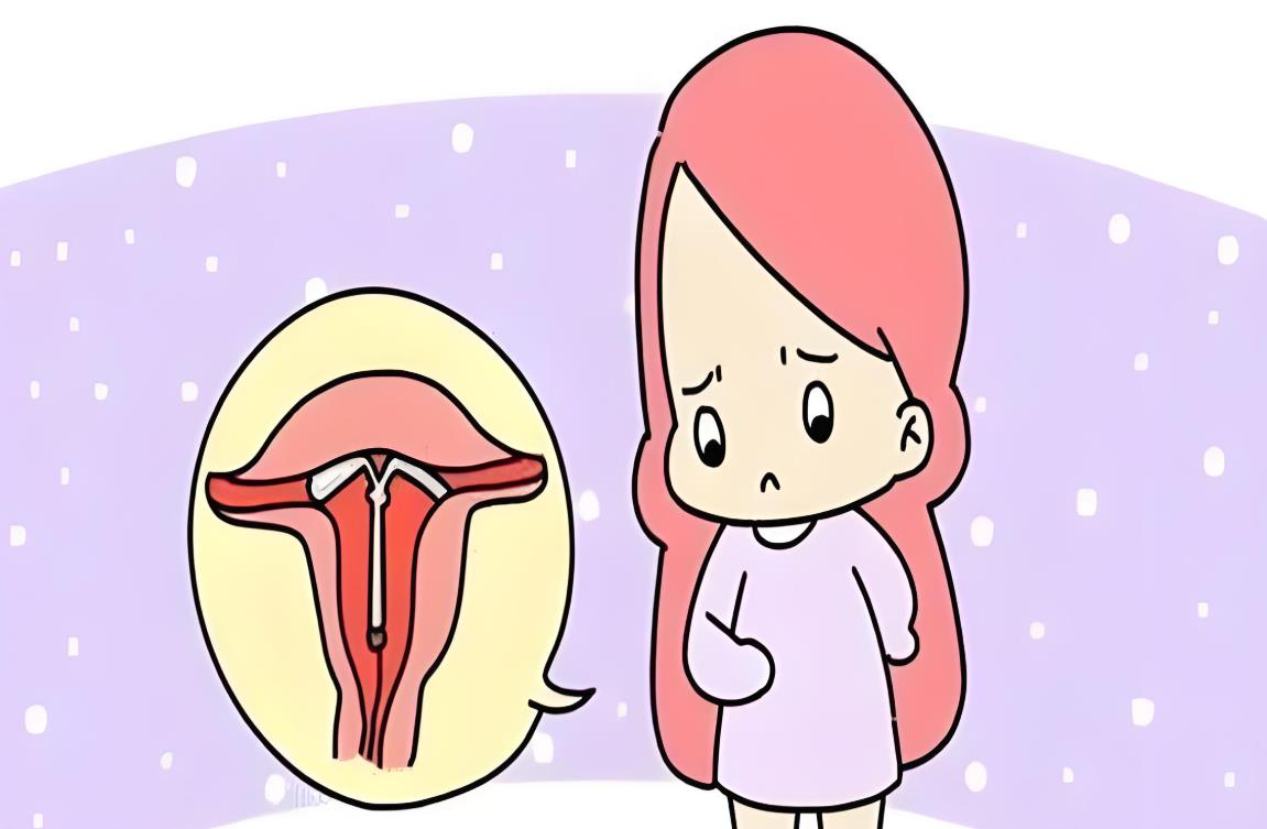 幼稚子宫