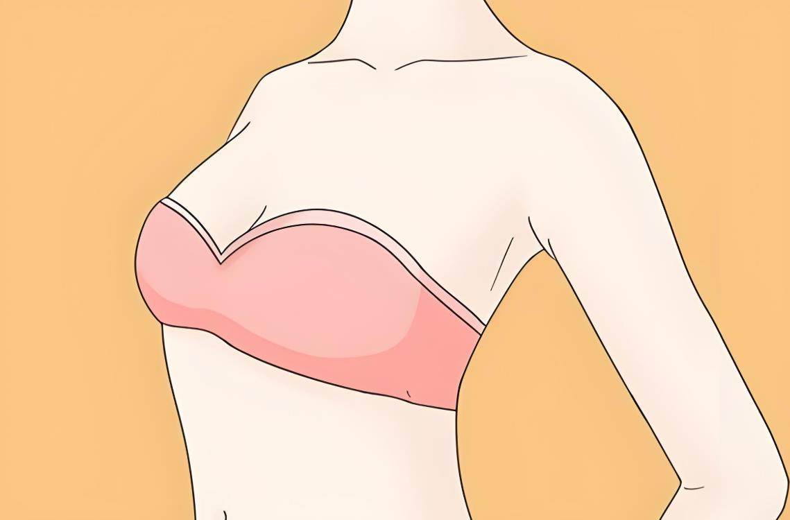 乳房发育