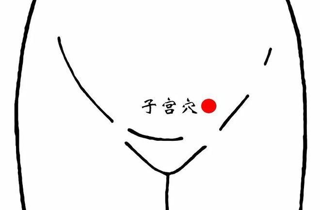 子宫穴
