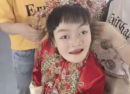 脑瘫女孩嫁唐氏丈夫！问题父母能否生出健康孩子？