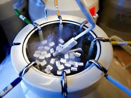 胚胎冷冻费用怎么算的？费用计算与影响因素