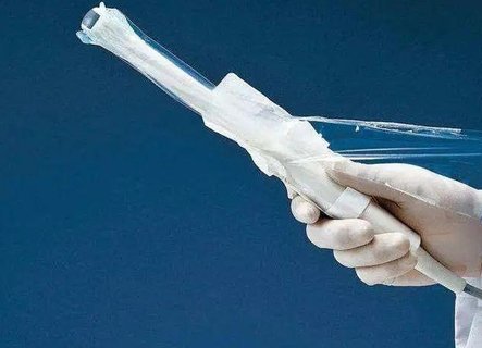 阴超对怀孕初期胚胎有影响吗？安全性和影响解析