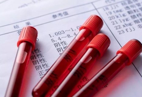 β人绒毛膜促性腺激素多少是怀孕？怀孕的标志