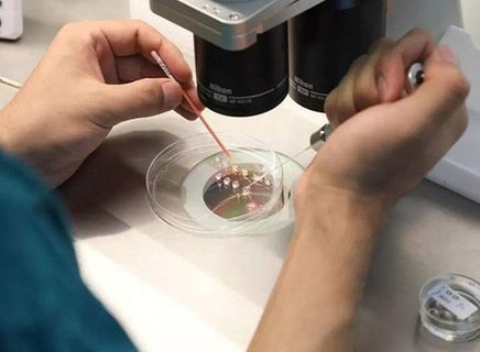 三代试管婴儿技术！预防遗传病的科学屏障