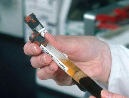 杭州试管婴儿费用大概要多少钱？杭州试管婴儿费用全解析