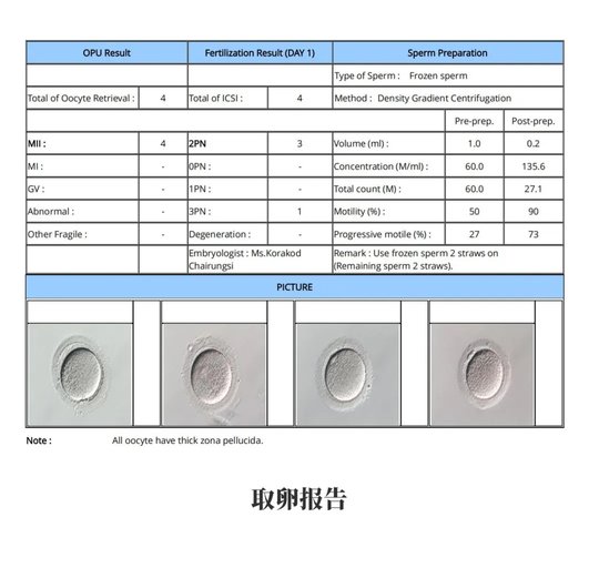 取卵报告